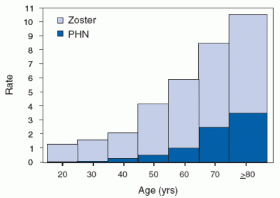 shingles-rates-by-age.gif
