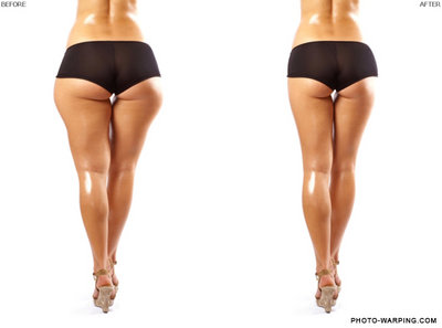 virtual-hips-buttock-liposuction-530.jpg