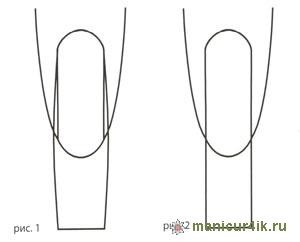 зажатый ноготь.jpg