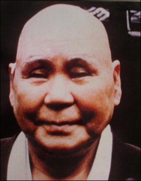 monk-with-no-sun-exposure.jpg