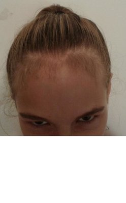 head.JPG